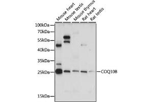 Western blot analysis of extracts of various cell lines, using COQ10B antibody (ABIN7266427) at 1:1105 dilution. (COQ10B anticorps  (AA 38-150))