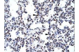 Image no. 1 for anti-Glial Cells Missing Homolog 1 (GCM1) (N-Term) antibody (ABIN6735857) (GCM1 anticorps  (N-Term))