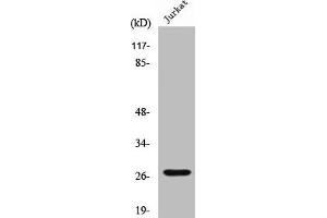 Western Blot analysis of Jurkat cells using Cleaved-Cathepsin C HC (R394) Polyclonal Antibody