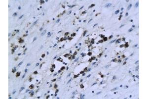Formalin-fixed and paraffin embedded human endometrial tissue labeled with Anti-XIAP/BIRC4 Polyclonal Antibody, Unconjugated (ABIN674364) followed by conjugation to the secondary antibody and DAB staining (XIAP anticorps  (AA 201-330))
