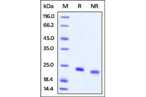 Biotinylated Human IL-4, Avitag,His Tag on  under reducing (R) and ing (NR) conditions.
