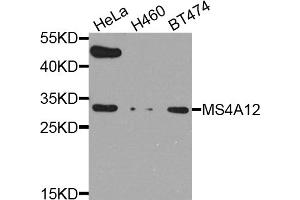 Western blot analysis of extracts of various cell lines, using MS4A12 antibody (ABIN5974527) at 1/1000 dilution.