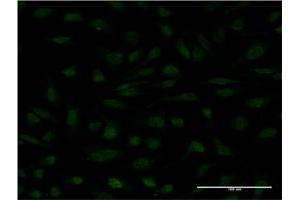 Immunofluorescence of monoclonal antibody to MYCBP on HeLa cell.