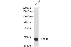 Western blot analysis of extracts of HL-60 cells, using LP antibody (ABIN7268335) at 1:1000 dilution. (EDG4 anticorps  (AA 250-350))