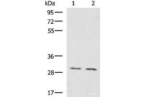 Western blot analysis of Mouse brain tissue Mouse kidney tissue lysates using KRCC1 Polyclonal Antibody at dilution of 1:1350 (KRCC1 anticorps)