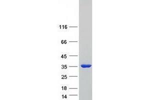 Validation with Western Blot