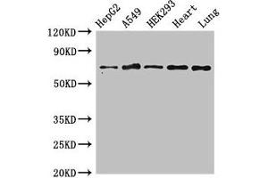 Western Blot Positive WB detected in: HepG2 whole cell lysate, A549 whole cell lysate, HEK293 whole cell lysate, Rat heart tissue, Rat lung tissue All lanes: EIF2AK1 antibody at 3 μg/mL Secondary Goat polyclonal to rabbit IgG at 1/50000 dilution Predicted band size: 72 kDa Observed band size: 72 kDa (EIF2AK1 anticorps  (AA 1-86))