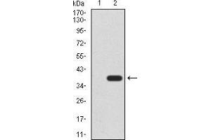 Western blot analysis using CK5 mAb against HEK293 (1) and CK5 (AA: 258-357)-hIgGFc transfected HEK293 (2) cell lysate.
