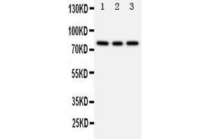 Western Blotting (WB) image for anti-Phosphoinositide 3 Kinase, p85 beta (PI3K p85b) (AA 447-461), (Middle Region) antibody (ABIN3044260)