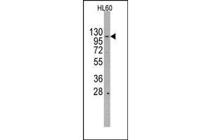 Image no. 1 for anti-HIR Histone Cell Cycle Regulation Defective Homolog A (HIRA) (Middle Region) antibody (ABIN358780) (HIRA anticorps  (Middle Region))