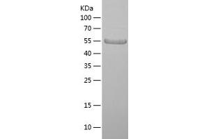 FURIN Protein (AA 108-371) (His-IF2DI Tag)