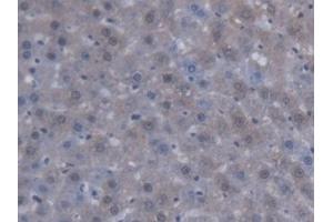 DAB staining on IHC-P; Samples: Rat Liver Tissue
