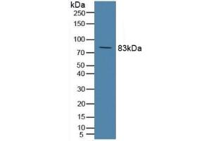 Detection of C2 in Rat Serum using Polyclonal Antibody to Complement Component 2 (C2) (Complement C2 anticorps  (AA 473-723))