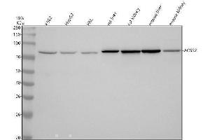 Western blot analysis of ACSS2 using anti-ACSS2 antibody (ABIN7603887).