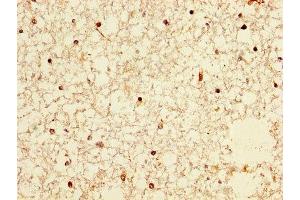 IHC image of ABIN7161390 diluted at 1:300 and staining in paraffin-embedded human brain tissue performed on a Leica BondTM system.