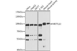 Western blot analysis of extracts of various cell lines, using METTL13 antibody (ABIN6131843, ABIN6143756, ABIN6143758 and ABIN6222922) at 1:1000 dilution. (METTL13 anticorps  (AA 540-699))