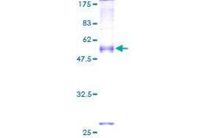 Image no. 1 for SEC22 Vesicle Trafficking Protein A (SEC22A) (AA 1-307) protein (GST tag) (ABIN1319403)