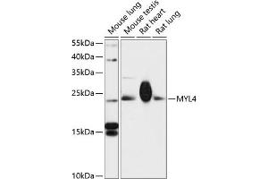 Western blot analysis of extracts of various cell lines, using MYL4 antibody (ABIN6129614, ABIN6144252, ABIN6144254 and ABIN6217179) at 1:3000 dilution. (MYL4 anticorps  (AA 1-197))
