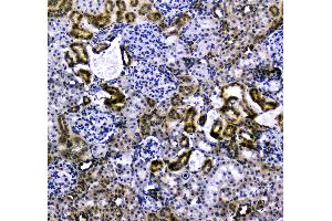 IHC analysis of VCAM1 using anti-VCAM1 antibody . (VCAM1 anticorps  (AA 25-270))