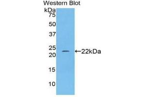 Detection of Recombinant NOS2, Rat using Polyclonal Antibody to Nitric Oxide Synthase 2, Inducible (NOS2) (NOS2 anticorps  (AA 518-694))