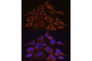 Immunofluorescence analysis of C6 cells using HPS4 antibody (ABIN7267623) at dilution of 1:100. (HPS4 anticorps  (AA 550-650))
