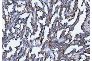 IHC analysis of Axin 2/AXIN2 using anti-Axin 2/AXIN2 antibody (ABIN7602177). (AXIN2 anticorps  (AA 614-843))