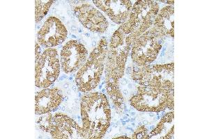 Immunohistochemistry of paraffin-embedded rat kidney using PLS1 antibody (ABIN7269391) at dilution of 1:100 (40x lens).