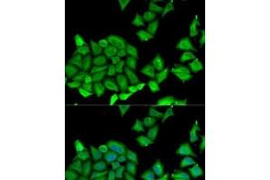 Immunofluorescence analysis of U2OS cells using RPS7 Polyclonal Antibody (RPS7 anticorps)