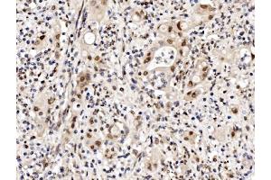 IHC analysis of Cbx8 using anti-Cbx8 antibody (ABIN7599341).