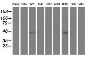 Image no. 2 for anti-serpin Peptidase Inhibitor, Clade A (Alpha-1 Antiproteinase, Antitrypsin), Member 5 (SERPINA5) antibody (ABIN1500058)