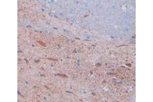 Detection of SP in Rat Spinal Cord Tissue using Polyclonal Antibody to Substance P (SP)