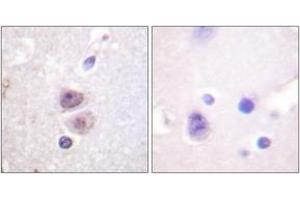 Immunohistochemistry (IHC) image for anti-Mitogen-Activated Protein Kinase 14 (MAPK14) (AA 288-337) antibody (ABIN2888769) (MAPK14 anticorps  (AA 288-337))