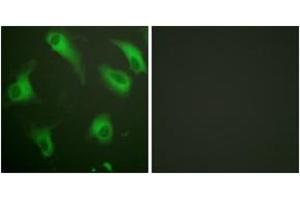 Immunofluorescence analysis of HeLa cells, using CD88/C5aR (Ab-338) Antibody. (C5AR1 anticorps  (AA 301-350))