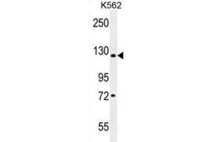 Western Blotting (WB) image for anti-Lysine (K)-Specific Demethylase 4C (KDM4C) antibody (ABIN2996198)