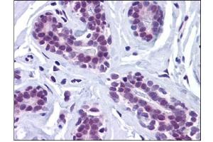 Human Breast: Formalin-Fixed, Paraffin-Embedded (FFPE) (Retinoblastoma Binding Protein 8 anticorps)