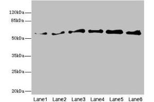 Western blot All lanes: PIP5K1B antibody at 5. (PIP5K1B anticorps  (AA 190-470))