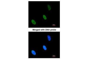 anti-Zinc Fingers and Homeoboxes 2 (ZHX2) (C-Term) antibody