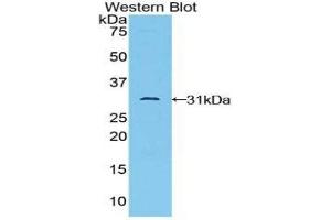 Western Blotting (WB) image for anti-TGF-beta Activated Kinase 1/MAP3K7 Binding Protein 1 (TAB1) (AA 189-439) antibody (ABIN1859749) (TAB1 anticorps  (AA 189-439))