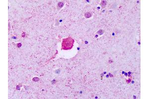 Anti-P2RY8 antibody IHC of human brain, cortex.