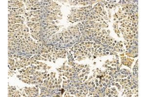 Cytochrome P450 2W1 Mouse Monoclonal Antibody at 1/100 staining mouse testis tissue by IHC-P.