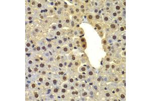 Immunohistochemistry of paraffin-embedded mouse liver using DTX2 antibody (ABIN6127799, ABIN6139853, ABIN6139854 and ABIN6223266) at dilution of 1:100 (40x lens). (DTX2 anticorps  (AA 1-280))
