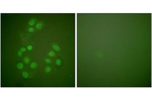 Immunofluorescence analysis of A549 cells, using CREB-BP Antibody. (CBP anticorps  (AA 2393-2442))