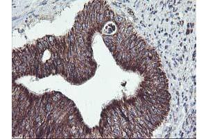 Immunohistochemistry (IHC) image for anti-TNF Receptor-Associated Protein 1 (TRAP1) antibody (ABIN1501500) (TRAP1 anticorps)