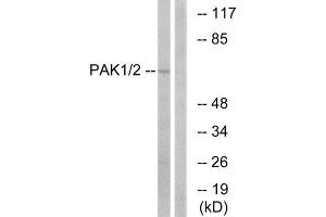 Western Blotting (WB) image for anti-P21 Protein (Cdc42/Rac)-Activated Kinase 1/2 (PAK1/2) (Ser199) antibody (ABIN1848058) (PAK1/2 anticorps  (Ser199))
