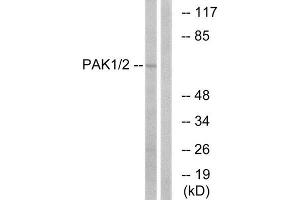 Western Blotting (WB) image for anti-P21 Protein (Cdc42/Rac)-Activated Kinase 1/2 (PAK1/2) (Ser199) antibody (ABIN1848058)