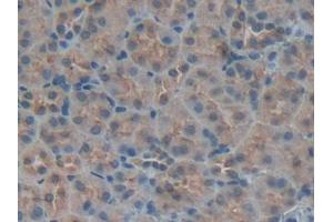 Used in DAB staining on fromalin fixed paraffin- embedded kidney tissue (IGFBP5 anticorps  (AA 25-271))