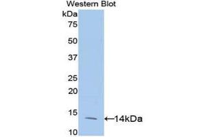 Western Blotting (WB) image for anti-Eukaryotic Translation Initiation Factor 4E Binding Protein 1 (EIF4EBP1) (AA 2-118) antibody (ABIN3202359) (eIF4EBP1 anticorps  (AA 2-118))