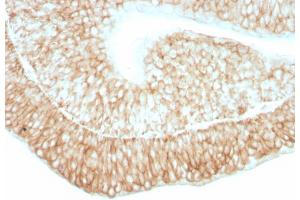 Formalin-fixed, paraffin-embedded human bladder stained with CD59 Mouse Monoclonal Antibody (193-27).