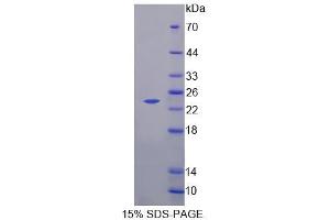 SDS-PAGE analysis of Human NCALd Protein.