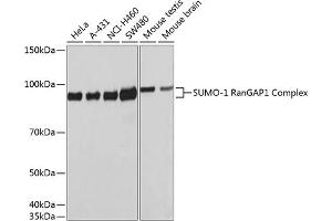 Western blot analysis of extracts of various cell lines, using SUMO1 antibody  at 1:1000 dilution. (SUMO1 anticorps)
